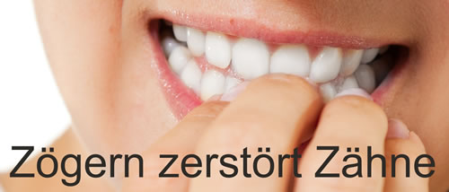 Anfangen: Zögern zerstört weitere Zähne